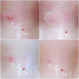 Miếng dán mụn Cosrx Clear Fit Master Patch / Cosrx Acne Pimple Master Patch 3