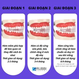 Niềng răng trong suốt tại nhà chính hãng Trainer - Bộ chỉnh nha dành cho trẻ em A1 + A2 + A3 8