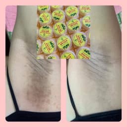[Combo 3 hộp * 10G] kem Cô Bơ triệt thâm nách hôi nách CỰC KÌ hiệu quả chỉ sau 1 liệu trình 6