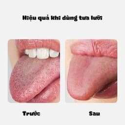 Dụng cụ cạo lưỡi (nạo lưỡi) vệ sinh miệng cao cấp 7