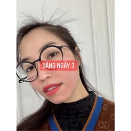 023 Plus Duyên Thị Bách Y Sâm 85ml - 25ml - 20ml Nuôi Da Từ Gốc Thế Hệ Mới - Bách Y Sâm 02 Mẫu Mới 8