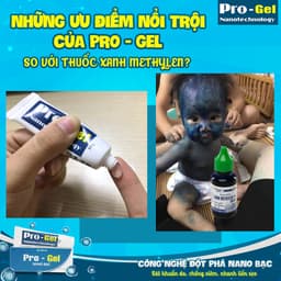 Kem Hăm Da, Bỏng, Tay Chân Miệng, Côn Trùng Đốt, Mụn Nhọt, Vết Thương Hở, An Toàn Cho Trẻ Sơ Sinh - Pro Gel Nano Bạc 3