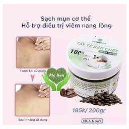 TẨY TẾ BÀO CHẾT THẢO MỘC MẸ KEN (DÀNH CHO BODY) 200ml 6