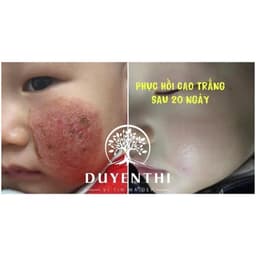 Cao Trắng Bạch Khiết Duyên Thị Lọ 30gr - Mẫu mới của Cao Trắng Da Duyên Thị - Phục hồi và giữ da mềm mịn 9