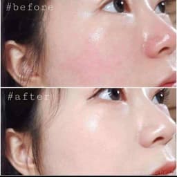 Serum Filler Aqua Kết Hợp Peptide Oz Witch Recipe 100ml Chính Hãng - Căng Bóng Thu Nhỏ Lỗ Chân 4