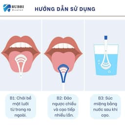 Dụng cụ cạo lưỡi (nạo lưỡi) vệ sinh miệng cao cấp 2