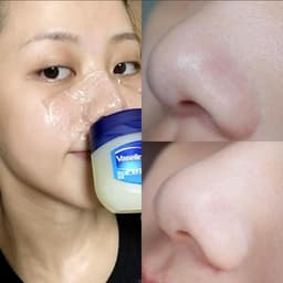 [S-VIP] (Hũ Lớn) Sáp Dưỡng Ẩm Vaseline Original Healing Jelly Đa Năng Hộp Lớn 369g 5