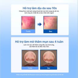 Kem Dưỡng Ẩm Hỗ Trợ Tái Tạo Da Dear Klairs Midnight Blue/Rich Moisture Clearing Water Cream 50g 5