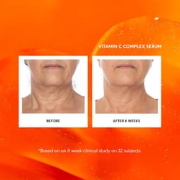 [Chính Hãng] Naturium Vitamin C Complex Serum 30ml | Authshop 3