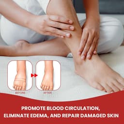 Chai Xịt Thảo Mộc Chân Phù Nề 30ml - Giúp Thư Giãn, Giảm Mỏi & Căng Cứng Vùng Phù Nề_DEAL SOCK   8
