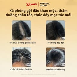"Dầu Gội Hà Thủ Ô 90g - Giảm Rụng Tóc, Tẩy Tế Bào Chết & Dưỡng Ẩm Tóc Khỏe Mạnh" 5