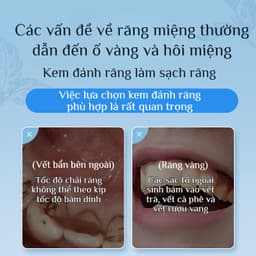 🔥Giá sốc🔥Kem đánh răng chăm sóc răng miệng chuyên nghiệp / Phù hợp cho cả gia đình / Làm trắng răng / Hơi thở thơm mát 3