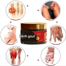 (Chính Hãng)  Kem Xoa Bóp Bôi Ngoài Da Baian Shi Tongfengao Giúp Giảm Đau Độ Gút Và Làm Dịu Cảm Giác Sưng Đỏ 3
