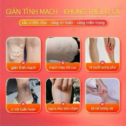 (Chính Hãng) Kem suy giãn tĩnh mạch–Hỗ trợ thông tĩnh mạch, giảm nổi gân xanh, giãn mao mạch và tắc nghẽn mạch máu 4