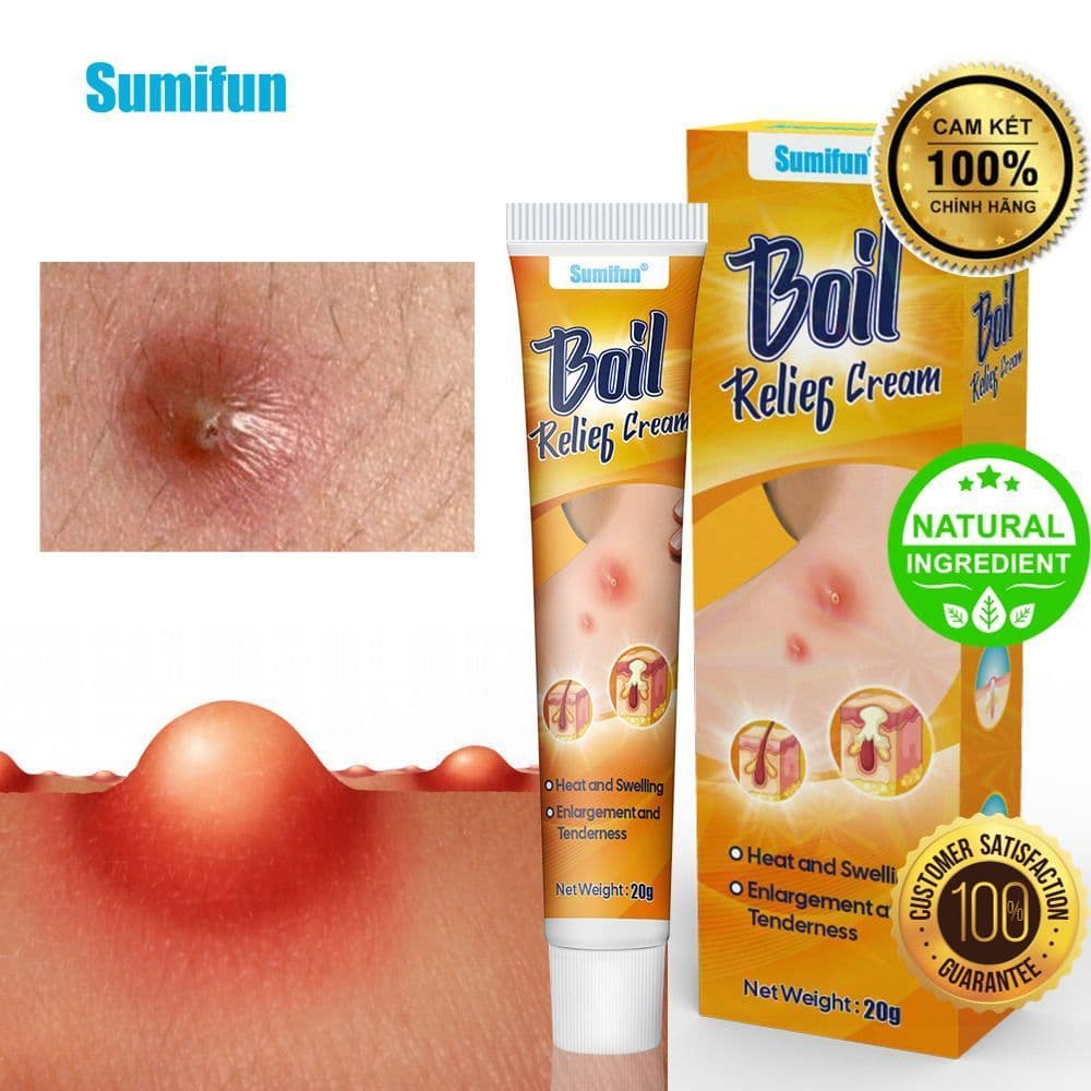 Kem Thảo Mộc Bôi Mụn Mủ, Mụn Nhọt, Mụn Bã Nhờn & Mụn Bội Nhiễm | DZÁ ZẺ BẤT NGỜ  