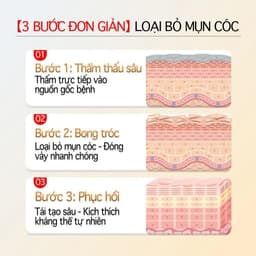 (Chính Hãng) (Hỏa Tốc) Kem bôi loại bỏ mụn thịt, mụn nhỏ ở cổ, mụn cóc ,Tuýp 20g 4