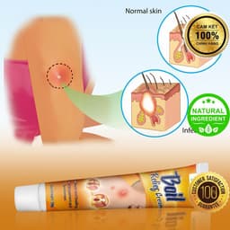 Kem Thảo Mộc Bôi Mụn Nhọt, Làm Dịu Mẫn Đỏ, Mụn Nang & Áp Xe Bề Mặt | DZÁ CỰC SỐC   1