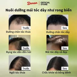 (Chính Hãng) Donan Xà phòng gội đầu - Làm sạch da đầu, giảm rụng tóc, kích thích mọc tóc mới, giúp tóc dày và chắc khỏe. 8