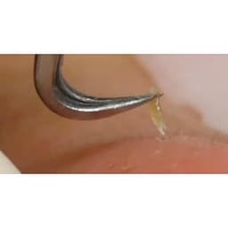 Nhíp Gắp Mụn Đầu Đen Trong Bộ Dụng Cụ Lấy Mụn Thần Thánh Dùng Cho Cá Nhân Spa & Thẩm Mỹ Viện. 5