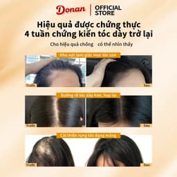 (Chính Hãng)Xà phòng gội đầu Donan - Làm sạch da đầu, ngăn rụng tóc, kích thích mọc tóc dày khỏe, phục hồi tóc hư tổn 5