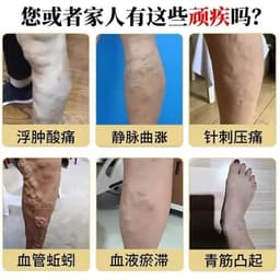 (Chính Hãng) (Hỏa Tốc) Kem Chăm Sóc Giãn Tĩnh Mạch Nhật Bản 30g - Giúp Giảm Gân Xanh, Đau Mỏi Chân, Phục Hồi Chân Đẹp 4