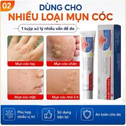 (Chính Hãng) (Hỏa Tốc) Kem bôi loại bỏ mụn thịt, mụn nhỏ ở cổ, mụn cóc, nách – Dưỡng da làm đẹp. 1