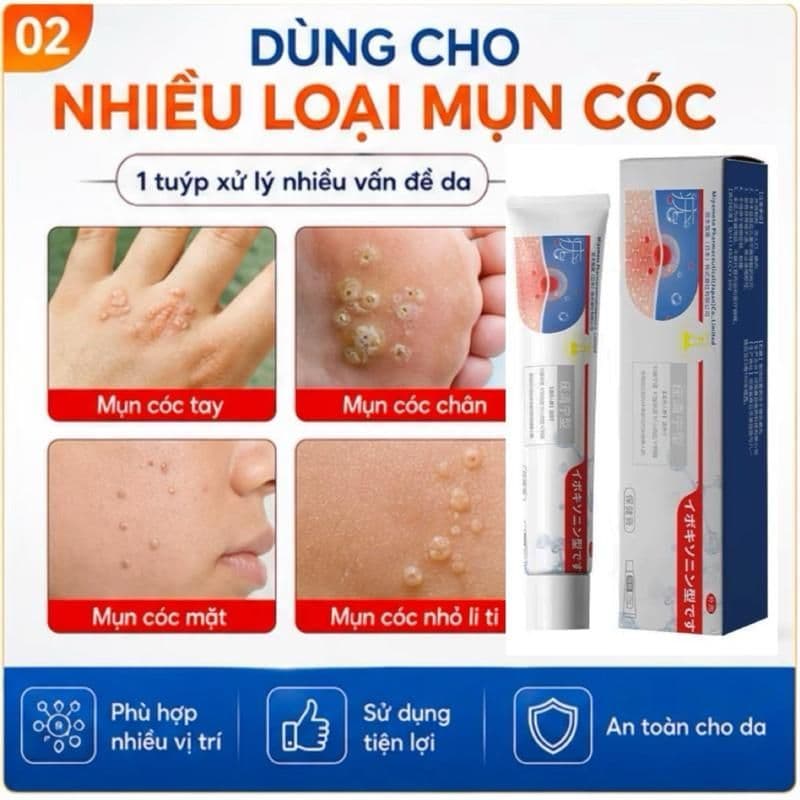 (Chính Hãng) (Hỏa Tốc) Kem bôi loại bỏ mụn thịt, mụn nhỏ ở cổ, mụn cóc, nách – Dưỡng da làm đẹp.