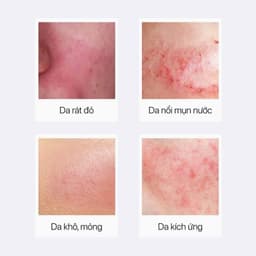 [HÀNG CÔNG TY] Theramid Copper Peptide Serum 30ml - Tinh chất Peptide Đồng phục hồi và trẻ hoá da 4