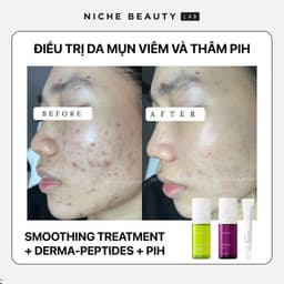 [HÀNG CÔNG TY] Serum Theramid Smoothing Treatment | Serum chống lão hóa và căng bóng da 4