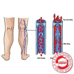 Hộp đựng viên uống Giảm Mỡ máu và xơ vữa động mạch Healthoil Nhật Bản 180v 4