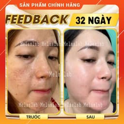 Serum tế bào gốc Bio Cellular Boost MELASLAB nuôi dưỡng tế bào giảm nám phục hồi da chống lão hóa 9