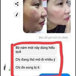 Vua Nghệ Collagen (Kem Nghệ),Kem Chống Nắng Nghệ Nhân Sâm, Kem Nám, Tàn Nhang, Sạm Da  Da Sáng và Mềm Mịn 4