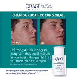 BHA Obagi Clenziderm M.D. Exfoliating BHA 2% Nước hoa hồng Cân bằng Toner tẩy tế bào chết, làm sạch mụn - 148ml 3
