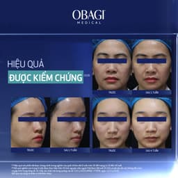 Obagi Medical Retinol + PHA Kem Dưỡng Đêm Làm Mới Và Duy Trì Độ Tươi Trẻ Tái Tạo Bảo Vệ Làn Da Ban Đêm - 50ml 2