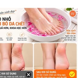 Máy chà gót chân mini,tẩy da chết chà gót chân chai sần,sạc usb ,2 tốc độ,3 đầu mài thay thế 6