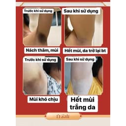 Xịt Khử Mùi Hôi Nách Hữu Cơ Khử Mùi Cơ Thể Khử Mùi Hôi Nách Chính Hãng Guangyao Baiyunshan 5