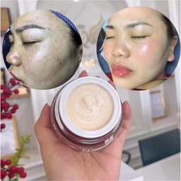 Kem N23 Duyên Thị 25gr Mẫu Mới Nhất - Kem dưỡng ẩm - trắng da - trẻ hóa N23 Bách Y Sâm 3