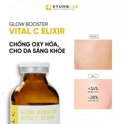 Serum vitamin C nồng độ 10% KyungLab Vital C làm mờ thâm, dưỡng sáng da 30ml 4