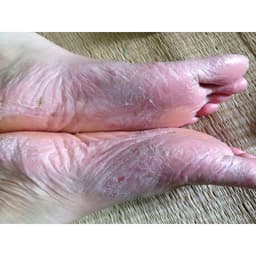 [Xanh Dương] Kem thảo dược hỗ trợ nấm, nứt nẻ đa năng 6