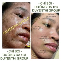 Combo Dưỡng Da 123 Duyên Thị - Bách Y Sâm - Phục Hồi Chuyên Sâu - Combo 5 chai (50ml) 9