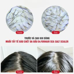 Muối Tẩy TBC Da Đầu Dr.FORHAIR Sea Salt Scaler 50g – Giảm Gàu, Giảm Rụng, Hỗ Trợ Mọc Tóc – Chính Hãng 4