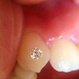 Đá đính răng SWAROVSKI GEMS Úc 2