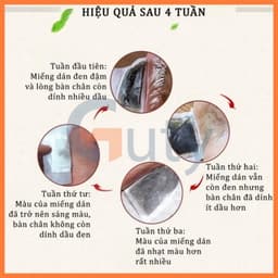 Hộp 50 miếng dán ngãi cứu thải độc cho bàn chân QA HAPPYLIFE giúp thải độc lưu thông tuần hoàn máu 5