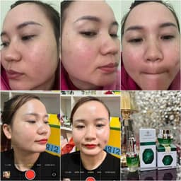 Kem nám và serum nám Huyền Phi giúp xóa các vết nám tàn nhang làm trắng sáng da 4