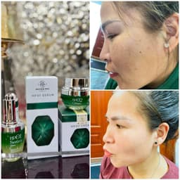 Kem nám và serum nám Huyền Phi giúp xóa các vết nám tàn nhang làm trắng sáng da 6