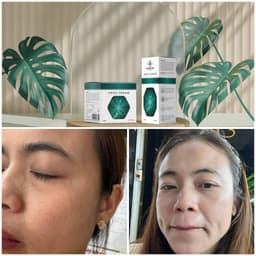 Kem nám và serum nám Huyền Phi giúp xóa các vết nám tàn nhang làm trắng sáng da 8