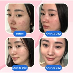 [S-VIP] Nước Hoa Hồng, Toner Dưỡng Ẩm Làm Sạch Da Compliment No Problem 200ml Chính Hãng Nga 4