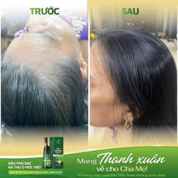 CHÍNH HÃNG Dầu Gội Phủ Bạc Mềm Mượt Mộc Việt 2