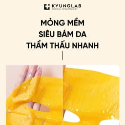 Mặt Nạ Dưỡng Trắng Da KyungLab Allantoin Ultra Light Hộp 5 Miếng 30ml | Skin Lab 6