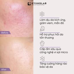 Mặt Nạ KyungLab Cica Calming Cấp Ẩm Phục Hồi Làm Dịu Da Hộp 5 Miếng 30ml | Skin Lab 5